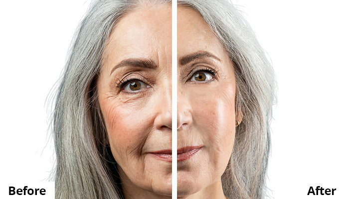 Before and After Comparison