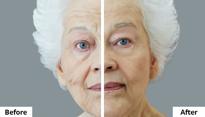 Before and After Comparison